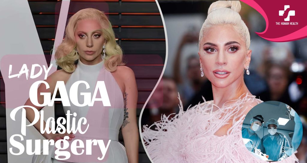 Lady Gaga Plastic Surgery: Eye-Opening New Look