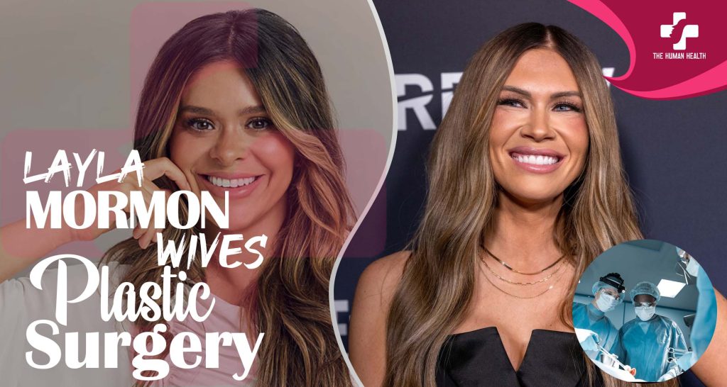 Layla Mormon Plastic Surgery: Exciting, Hidden, Verified