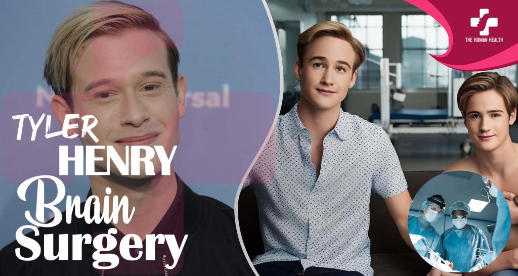 Tyler Henry Brain Surgery: Remarkable, Stunning Truth