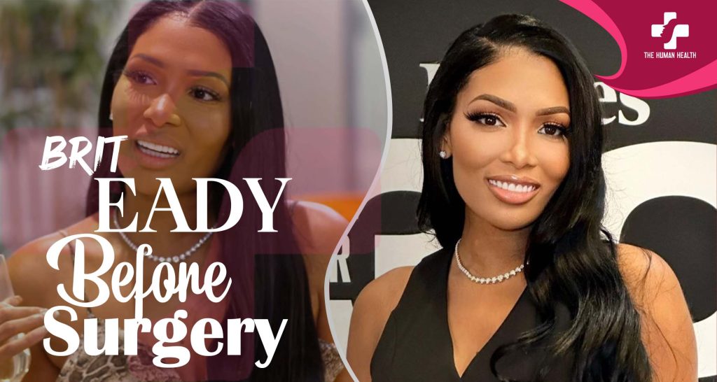 Brit Eady Before Surgery: Exclusive, Eye-Opening Look