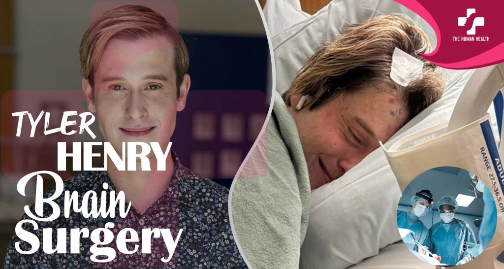 Tyler Henry Brain Surgery: Remarkable, Stunning Truth